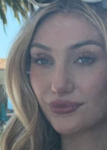 Cameron Brink Strikes One Pose After Another in a Swimsuit After Bachelorette